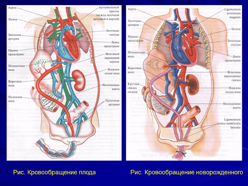 Рис. Кровообращение новорожденного  Рис. Кровообращение плода